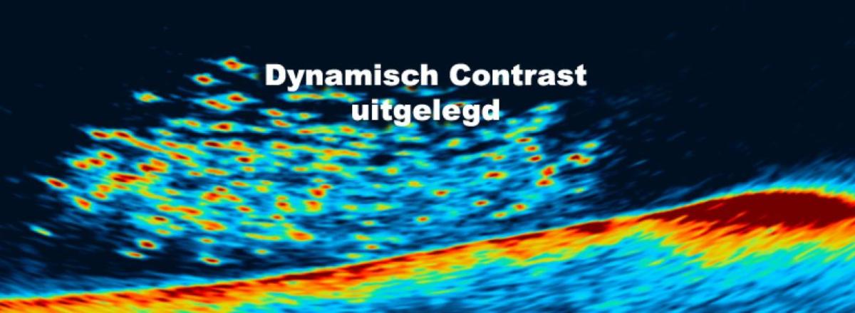 MEGA Live 2 dynamisch contrast uitgelegd: Gebalanceerd, Hoog en Laag